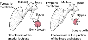 biomedres-openaccess-journal-bjstr