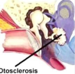 biomedres-openaccess-journal-bjstr