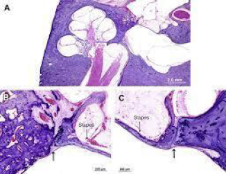 biomedres-openaccess-journal-bjstr