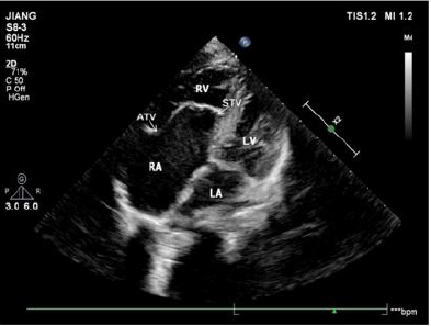 biomedres-openaccess-journal-bjstr