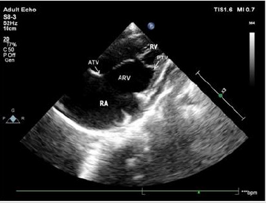 biomedres-openaccess-journal-bjstr