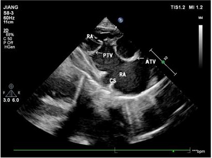 biomedres-openaccess-journal-bjstr