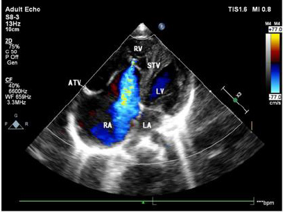 biomedres-openaccess-journal-bjstr