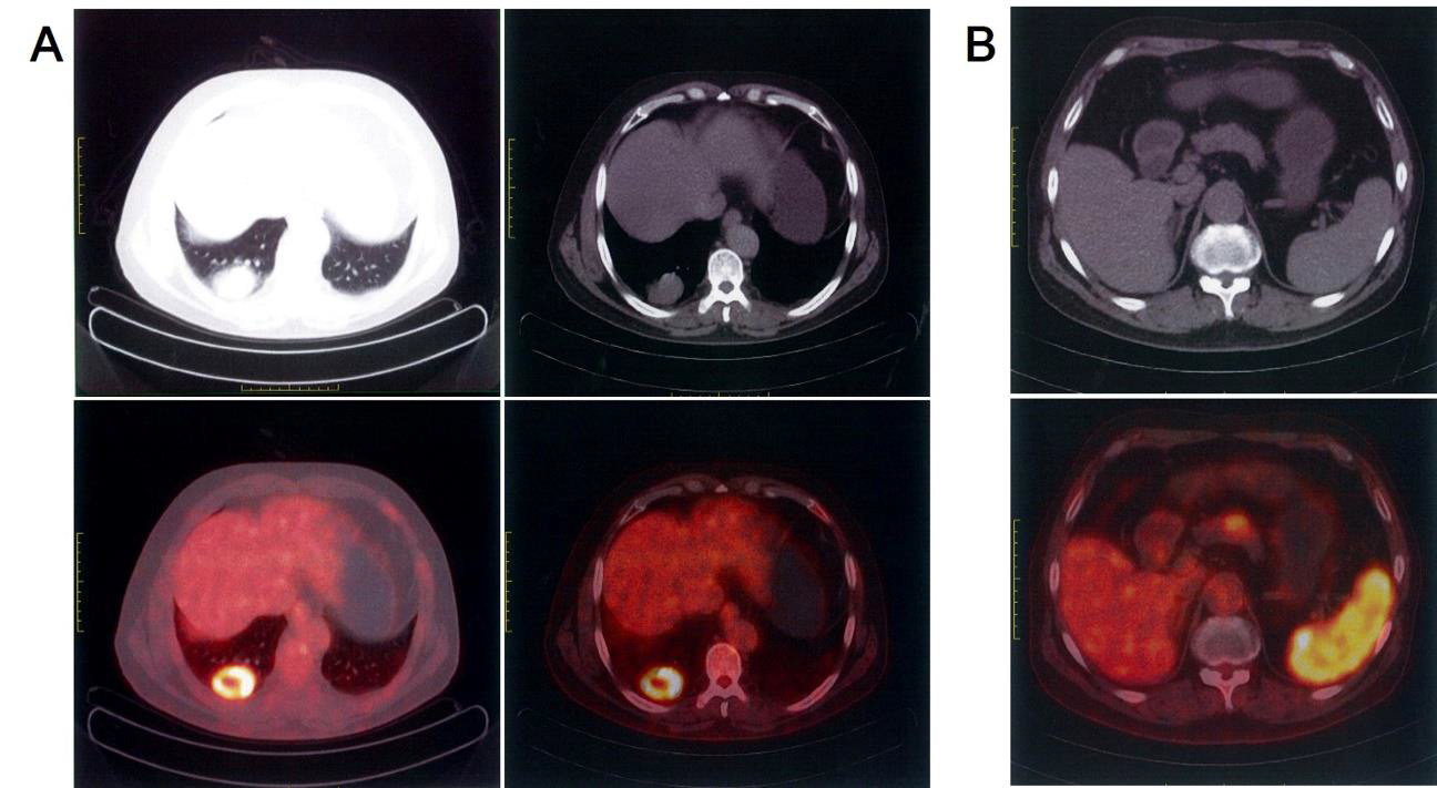 biomedres-openaccess-journal-bjstr