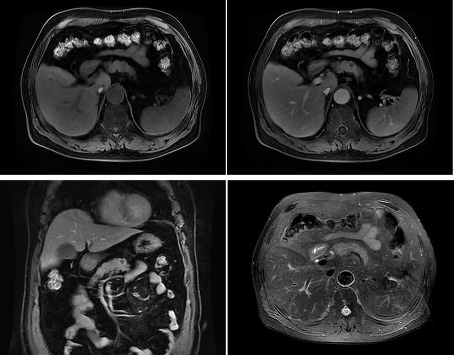 biomedres-openaccess-journal-bjstr