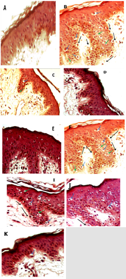 biomedres-openaccess-journal-bjstr