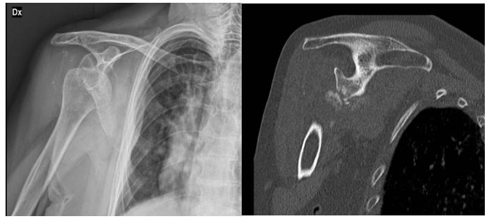 biomedres-openaccess-journal-bjstr