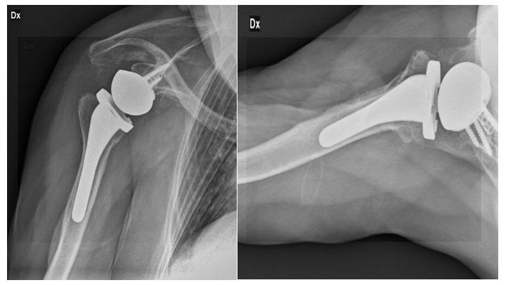 biomedres-openaccess-journal-bjstr
