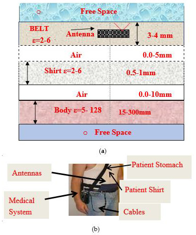 biomedres-openaccess-journal-bjstr