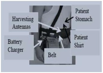 biomedres-openaccess-journal-bjstr