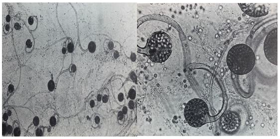 biomedres-openaccess-journal-bjstr