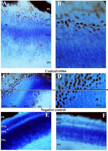 biomedres-openaccess-journal-bjstr