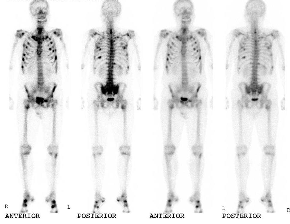 biomedres-openaccess-journal-bjstr