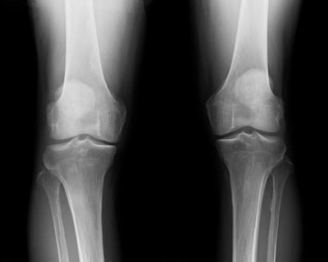 biomedres-openaccess-journal-bjstr