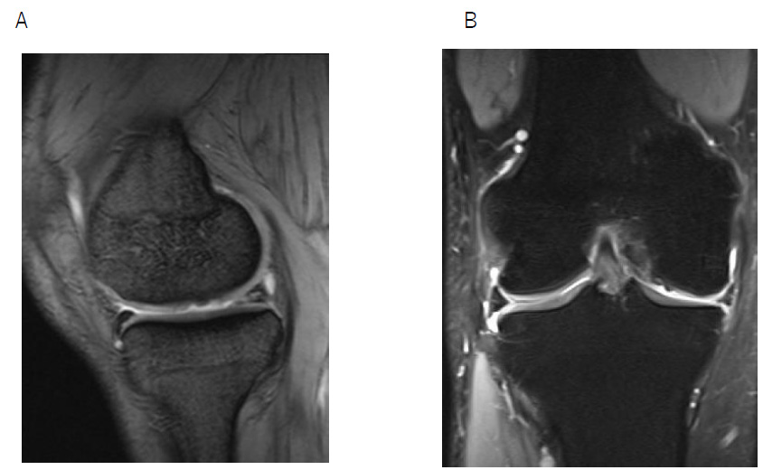 biomedres-openaccess-journal-bjstr