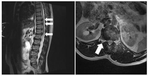 biomedres-openaccess-journal-bjstr