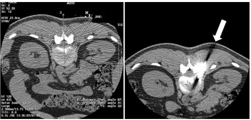 biomedres-openaccess-journal-bjstr