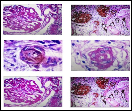 biomedres-openaccess-journal-bjstr
