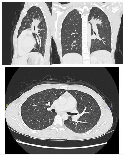 biomedres-openaccess-journal-bjstr
