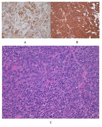 biomedres-openaccess-journal-bjstr
