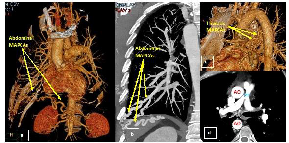 biomedres-openaccess-journal-bjstr