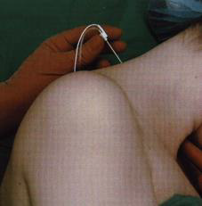 biomedres-openaccess-journal-bjstr