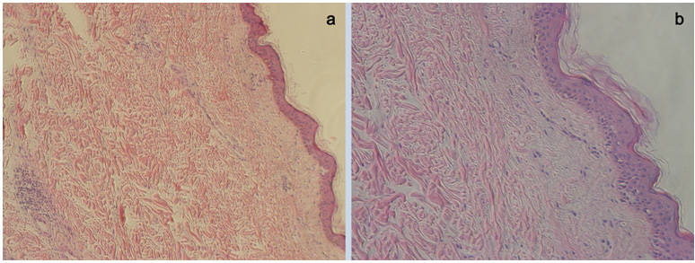 biomedres-openaccess-journal-bjstr