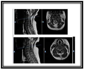 biomedres-openaccess-journal-bjstr