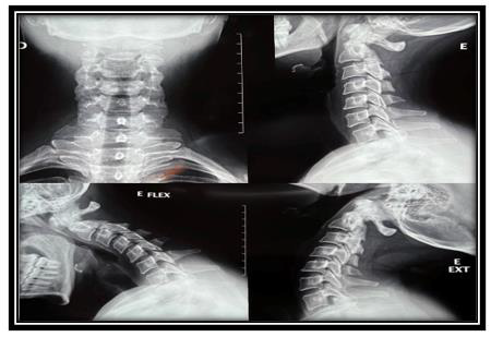 biomedres-openaccess-journal-bjstr