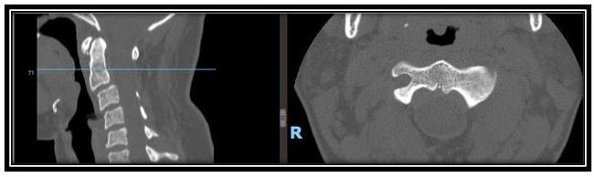 biomedres-openaccess-journal-bjstr