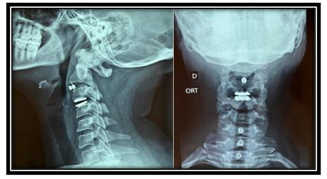 biomedres-openaccess-journal-bjstr
