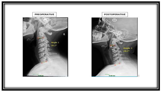 biomedres-openaccess-journal-bjstr