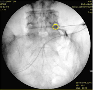 biomedres-openaccess-journal-bjstr
