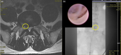 biomedres-openaccess-journal-bjstr