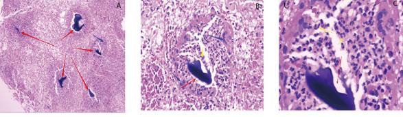 biomedres-openaccess-journal-bjstr