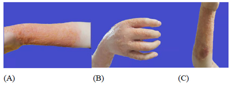 biomedres-openaccess-journal-bjstr