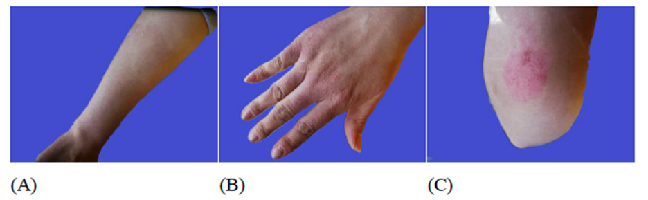 biomedres-openaccess-journal-bjstr