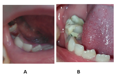 biomedres-openaccess-journal-bjstr