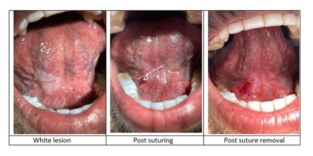 biomedres-openaccess-journal-bjstr