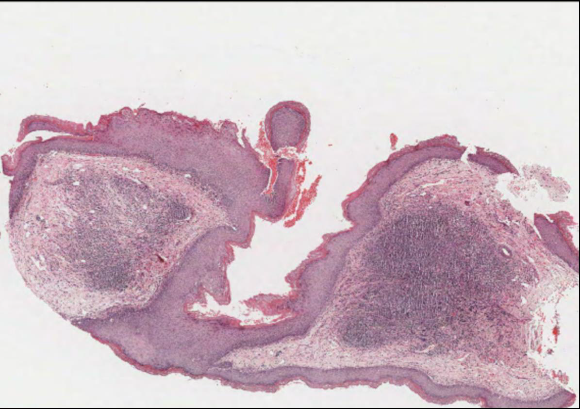 biomedres-openaccess-journal-bjstr