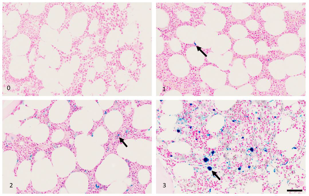 biomedres-openaccess-journal-bjstr