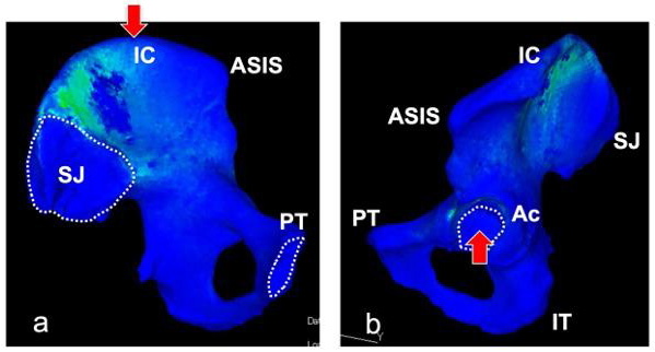 biomedres-openaccess-journal-bjstr