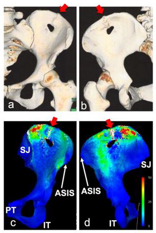 biomedres-openaccess-journal-bjstr