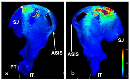 biomedres-openaccess-journal-bjstr