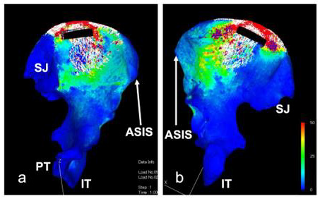 biomedres-openaccess-journal-bjstr