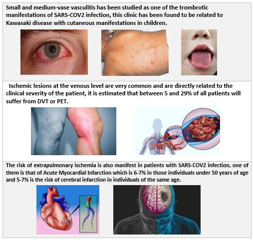 biomedres-openaccess-journal-bjstr