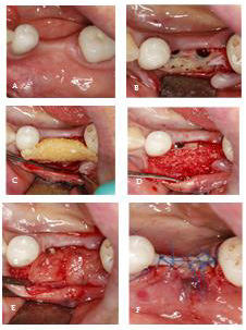 biomedres-openaccess-journal-bjstr