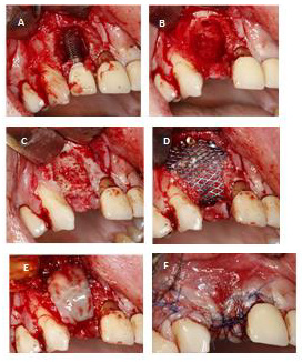 biomedres-openaccess-journal-bjstr