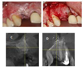 biomedres-openaccess-journal-bjstr