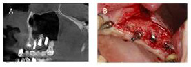 biomedres-openaccess-journal-bjstr